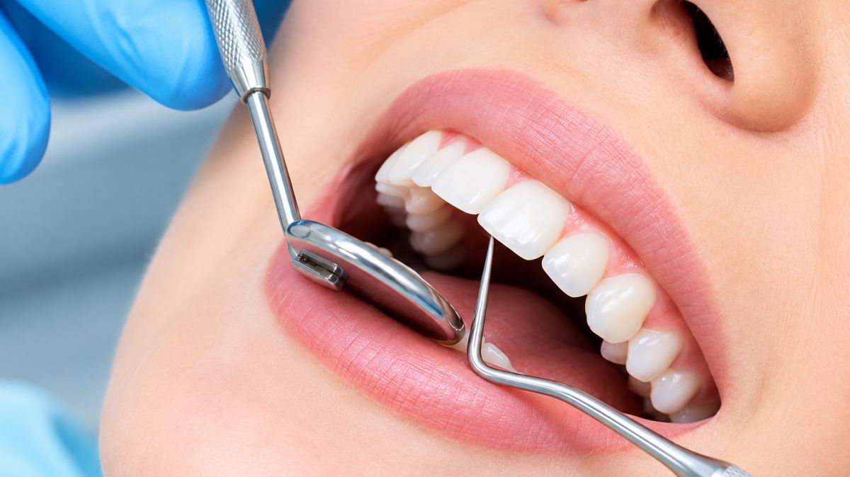 cosmetic dentistry in Punawale,  cosmetic dentistry in Pune,  cosmetic dentist in Punawale,  cosmetic dentist in Pune,  smile makeover Punawale,  smile makeover Pune,  aesthetic dentistry Pune,  cosmetic dental treatment Pune,  smile enhancement Pune,  Dr. Hileri Mori