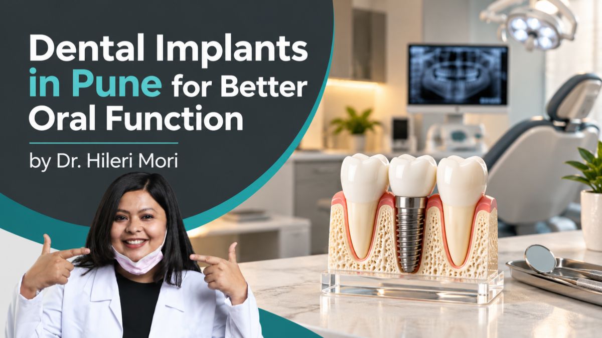 Dental implants in Pune, Affordable tooth replacement in Pune, Dental implant cost in Pune, Best dental implants in Pune, Dental implant specialist in Pune, Missing teeth treatment in Pune, Tooth replacement options in Pune, Implant supported bridge in Pune, Full arch dental implants in Pune, Single tooth implant in Pune